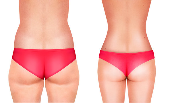 Lines, showing surgery on female body. Vector.