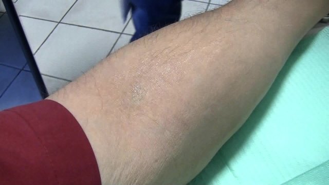 Analisi del sangue- Blood tests