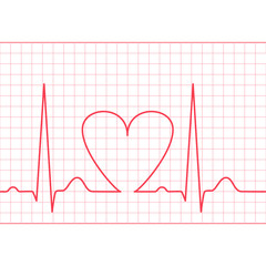 ECG - electrocardiogram feed