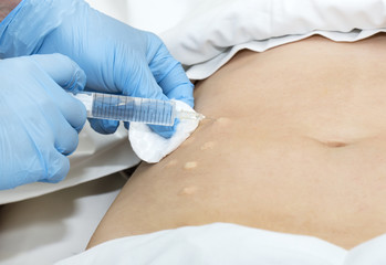 woman is in the process cellulite mesotherapy clinic