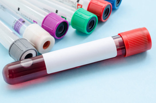 blood samples tube for screening test.