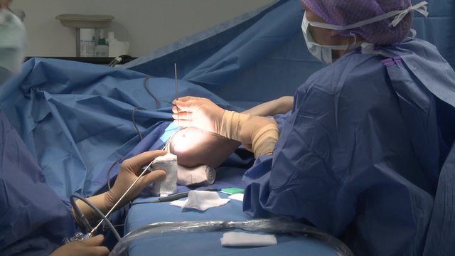 surgery in an operating room/Use of a contact endoscope and record HD
