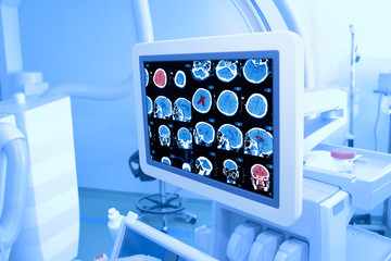 Monitor in the kathlabe.