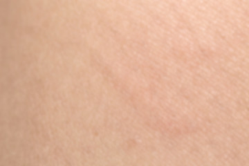 Human skin texture with black hairs on the skin for healthy back
