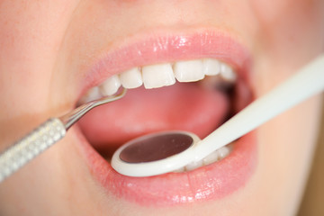 Dentist looking into a woman's mouth