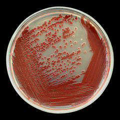 Red bacterial colonies on a petri plate ( dish ) isolated on a black background. Oil-degrading bacteria used. Nutrient agar media used.  Focus on full depth. 