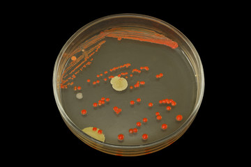 Colonies of oil-oxydizing bacteria of red-orange color on a petri plate (dish) isolated on black. Nutrient agar media used.  Focus on full depth.