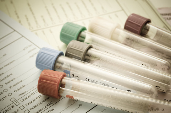 The old blood tubes for test on reqest form medical testing