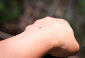 Fototapeta premium mosquito on hand.