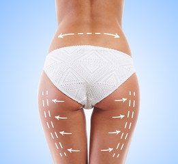 Woman in white panties with arrows on her legs. Cellulite removal concept.