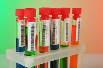 Test tubes with colorful liquid on light color background