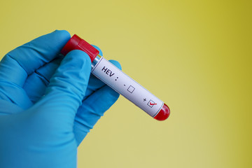 Hepatitis E virus (HEV) positive