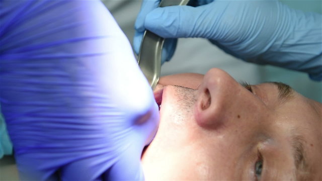Dental implantation procedure. Healthcare dentistry medicine concept