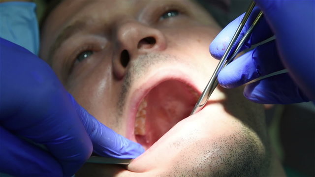 Dentist sews the gum, implantation concept