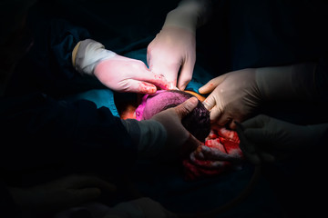 Newborn baby in labor room