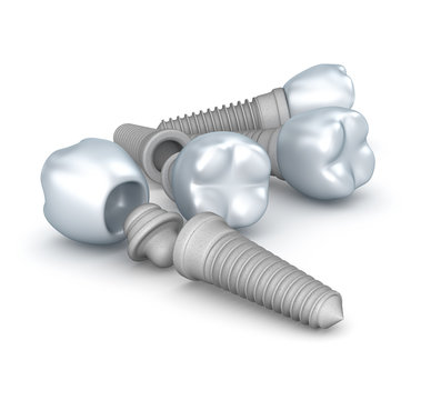 Dental implants, crowns and pins isolated on white