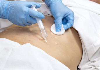woman is in the process cellulite mesotherapy clinic