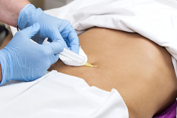 woman is in the process cellulite mesotherapy clinic