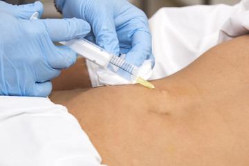 woman is in the process cellulite mesotherapy clinic
