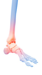 medical 3d illustration of a painful ankle