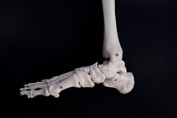 Medial View of The Foot 