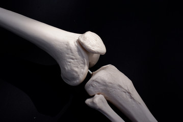 Bones of the Knee 