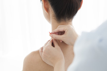 Acupuncturists are pierced acupuncture to women's shoulder