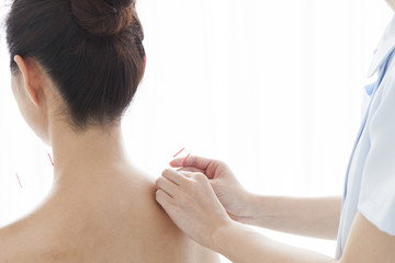 Women are stabbed acupuncture to shoulder