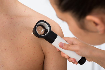 Person Examining Acne Skin With Dermatoscope
