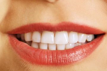 Woman's white teeth