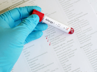 Allergy testing positive