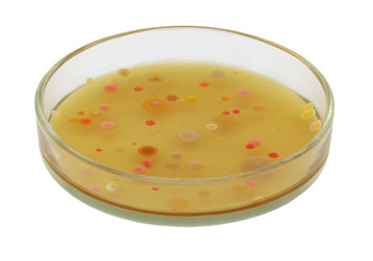 Different color, size and type colonies of bacteria from public premises air on a petri dish (agar plate) isolated on white background.