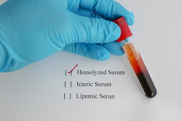 Hemolyzed blood sample
