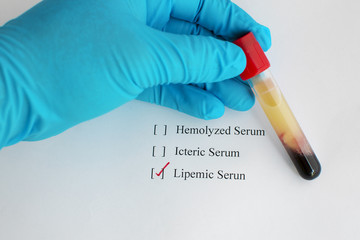 Lipemic blood sample