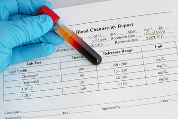 Normal lipid profile result with blood sample