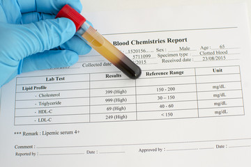High lipid profile result with blood sample