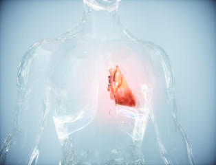 Herzattacke im gläsernen Menschen - obrazy, fototapety, plakaty