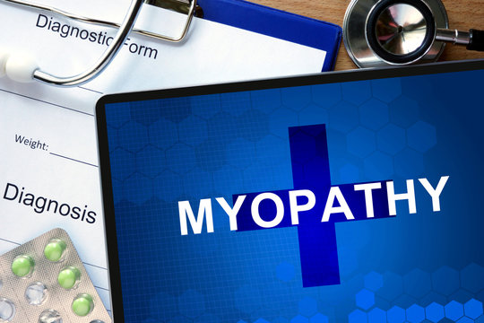 Word  Myopathy on a notepad and pills on the wooden table.