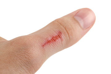 Cut Finger