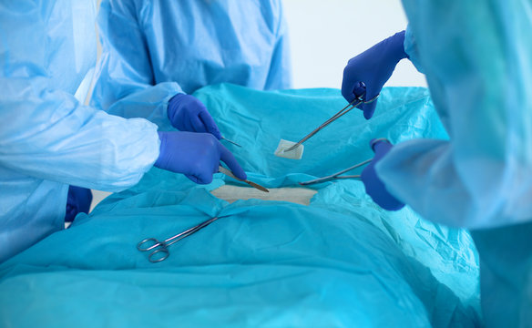 Team of surgeon in uniform perform operation on a patient at