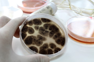 検査イメージ　Aspergillus brasiliensis