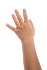Obraz premium eczema on baby's hand