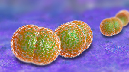 Meningitis Bacteria Infection