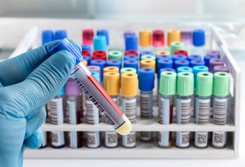 laboratory technician holding a blood tube test labeled with bar / hand of a lab technician holding blood tube test and background a rack of color tubes