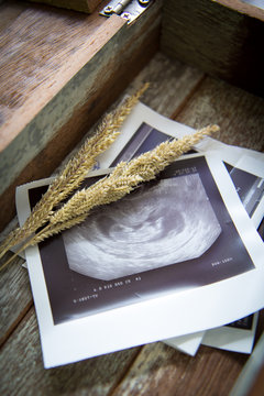Memories of infant baby ultrasound Images in a vintage wooden bo