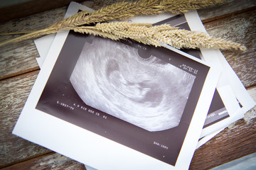 Memories of infant baby ultrasound Images in a vintage wooden bo