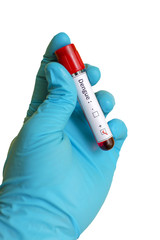 Dengue virus positive