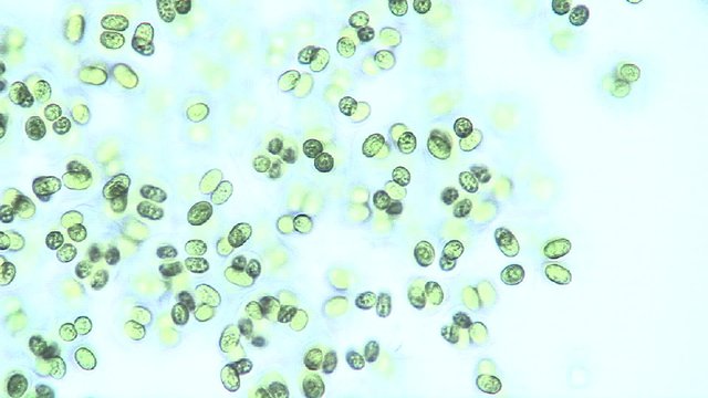 Microscopic view of Glocothece sp. algae in pairs. Their lime color shines as they are in and out of focus during this microscope examination.