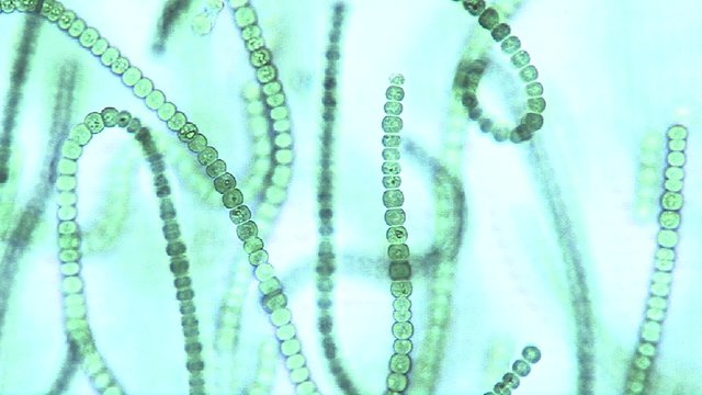 Microscopic view of chains of algae, these cyanobacteria, Microcystis sp., are a sort of blue green algae which live in fresh water.
