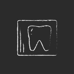 X-ray of the tooth icon drawn in chalk.
